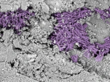 In this microscope image of a Bennu sample, needles of hydrated sodium carbonate — one of the salts left behind by evaporating brine — are highlighted in purple false color